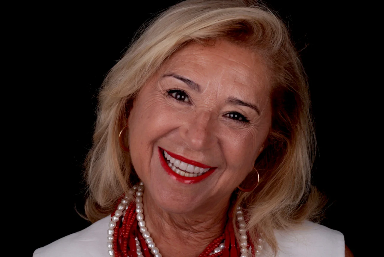 clinica-dental-gilbel-arques-caso-carillas-mjll-despues
