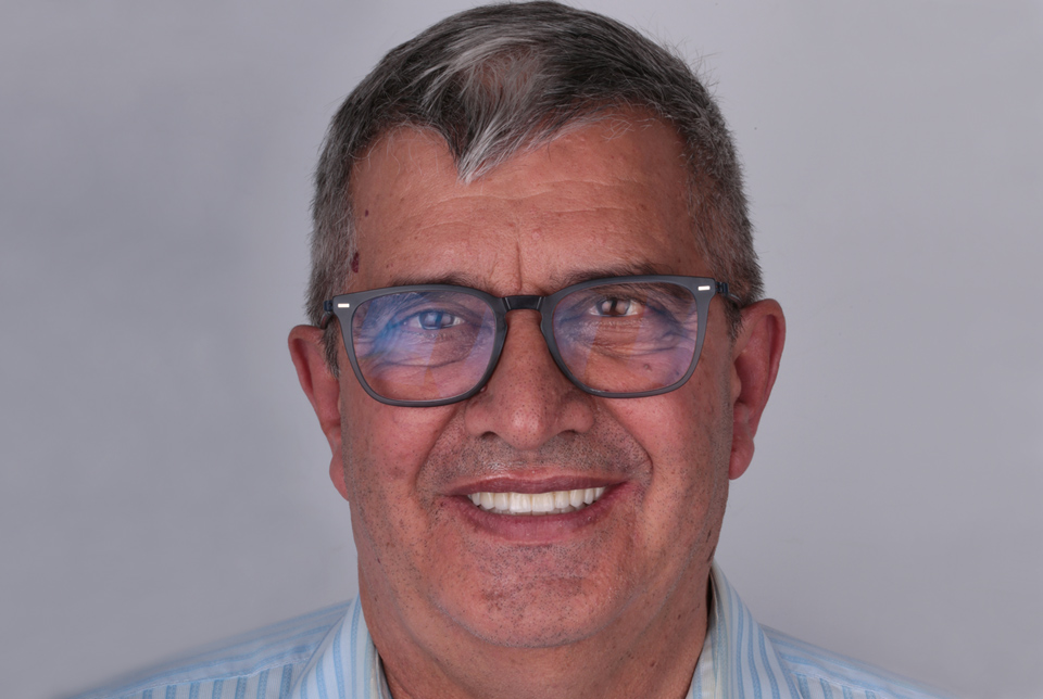 clinica-dental-gilbel-arques-caso-implente-dental-mbm-despues