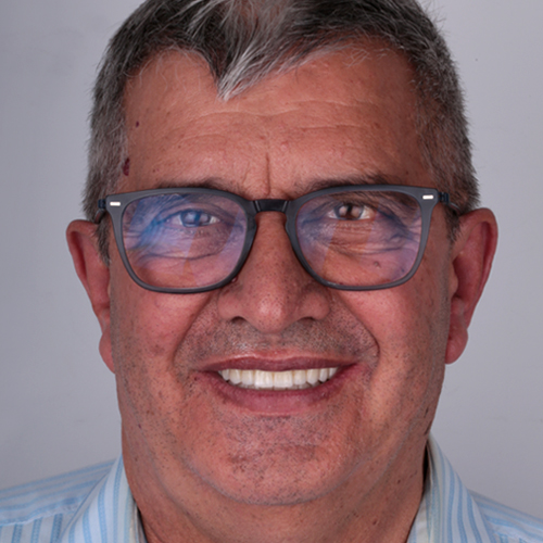 clinica-dental-gilbel-arques-inicio-caso6
